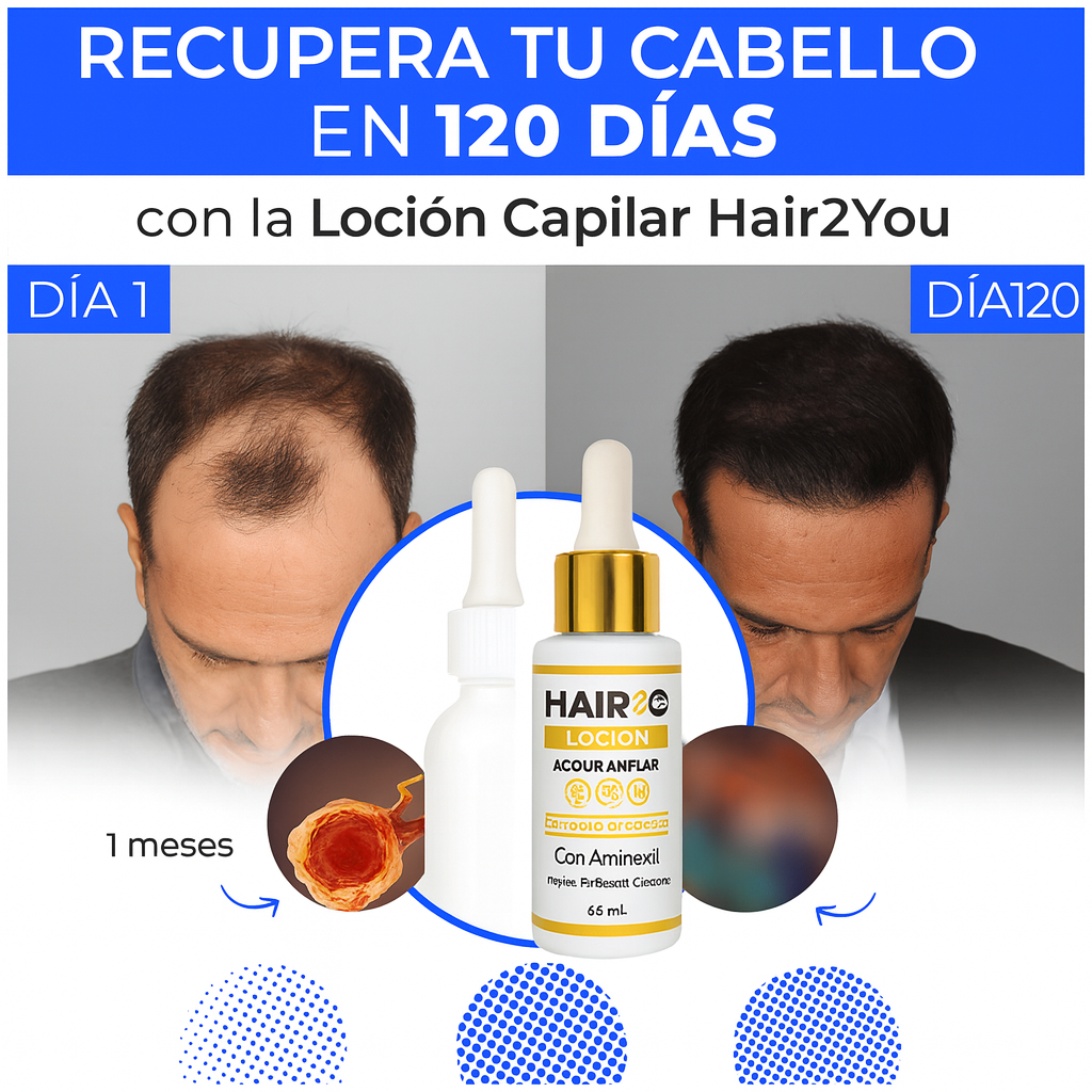 Recupera tu cabello en 120 días con la Loción Capilar Hair2You – o te devolvemos tu dinero