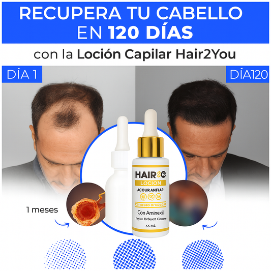 Recupera tu cabello en 120 días con la Loción Capilar Hair2You – o te devolvemos tu dinero
